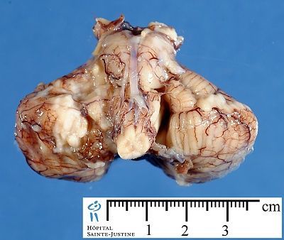 jpg_cerebellum_brainstem_1m_12_1a.jpg