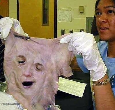 transplantface.jpg