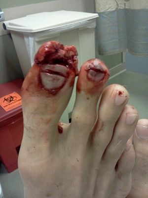 big-20toe.jpg
