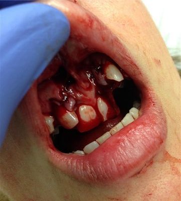 softball-20mishap.jpg