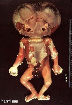 baby_06.jpg