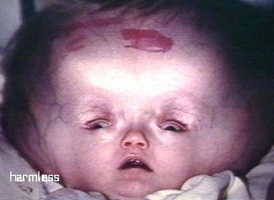 baby_22.jpg