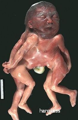 baby_29.jpg