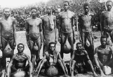 Elephantitis-balls.jpg