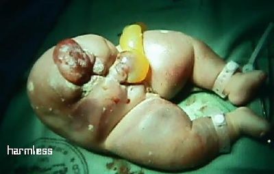 baby_30.jpg