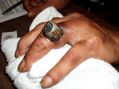 ring.jpg