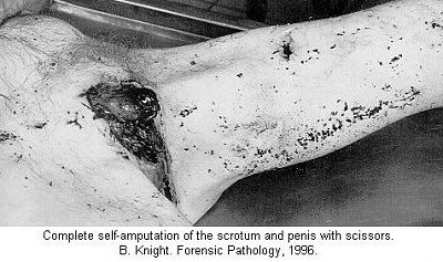cut-his-bits-off-scissors.jpg