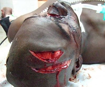 head_injury.jpg