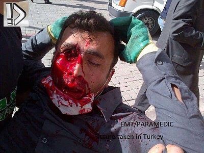 shot-20by-20turkish-20police.jpg