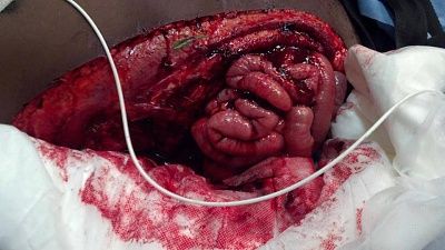 intestines.jpg