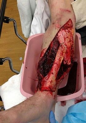 injuries-20-281-29.jpg