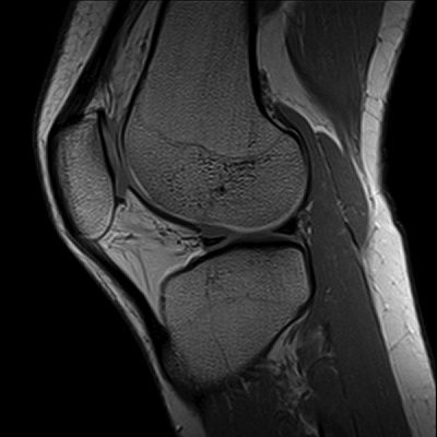 mri.jpg