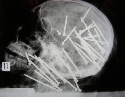 rt_nailgun_x-ray_090424_ssh.jpg