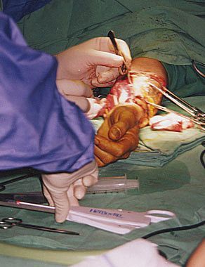 phalloplasty1.jpg