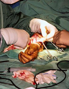 phalloplasty3.jpg