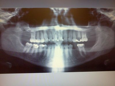 xray.jpg