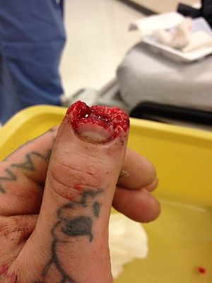 thumb.jpg