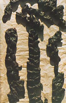 colon1.jpg