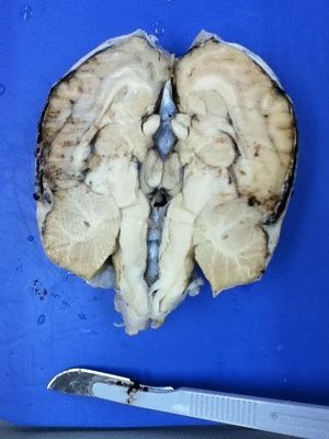 dissected-20sheeps-20brain-20-281-29.jpg