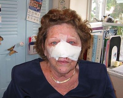 flesh-eating-disease-1.jpg