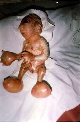 du-baby-afghanistan-3.jpg