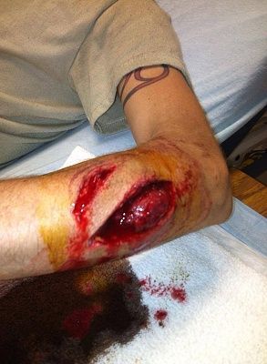 gash.jpg