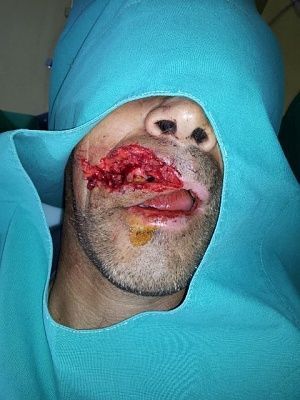 lip.jpg