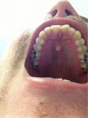 tooth1.jpg