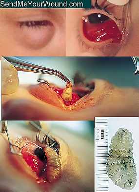 flyintheeye_001.jpg