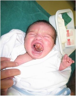 snuffx-dot-com-birthdefect1.jpg