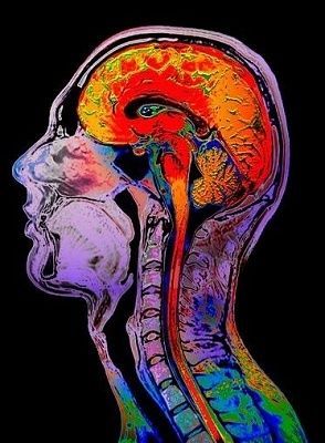 normalmri.jpg