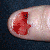 nail.gif