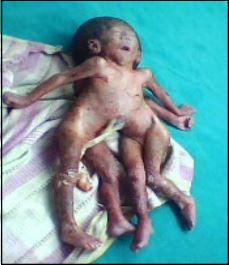 Syncephalus_010.jpg