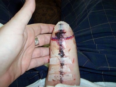 snuffx-dot-com-dickinfection.jpg