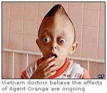 agent_orange_vietnamese_child_deformed.jpg