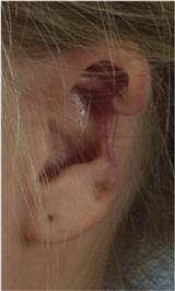 ear.jpg