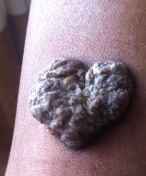 tat3.jpg