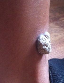 tat2.jpg