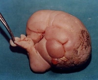 parasitic-20twin.jpg