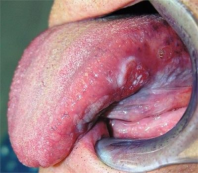 tongue.jpg