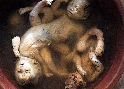 deformed-20stillbirths-20from-20agent-20orange-20exposure.jpg