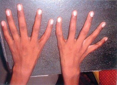 thumb.jpg