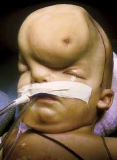 deform%20baby.jpg