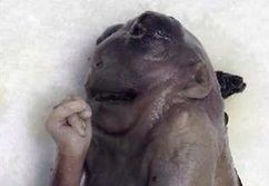 509088d1390150099-terminated-fetus-anencephaly-clubbed-feet-20terminated-20fetus-20with-20anence.jpg