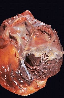 heart.jpg