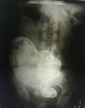 img18_1.jpg