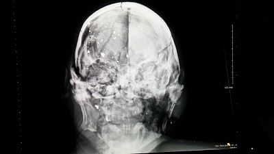 xray.jpg