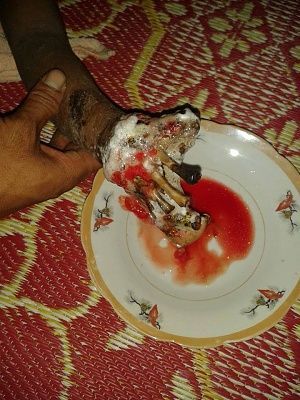 rotten-20hand-20-281-29.jpg