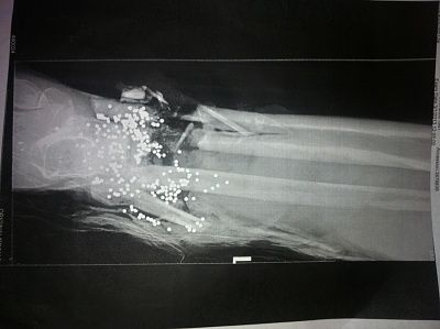 xray2.jpg