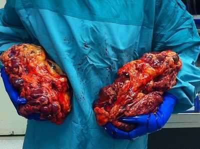 kidneys.jpg